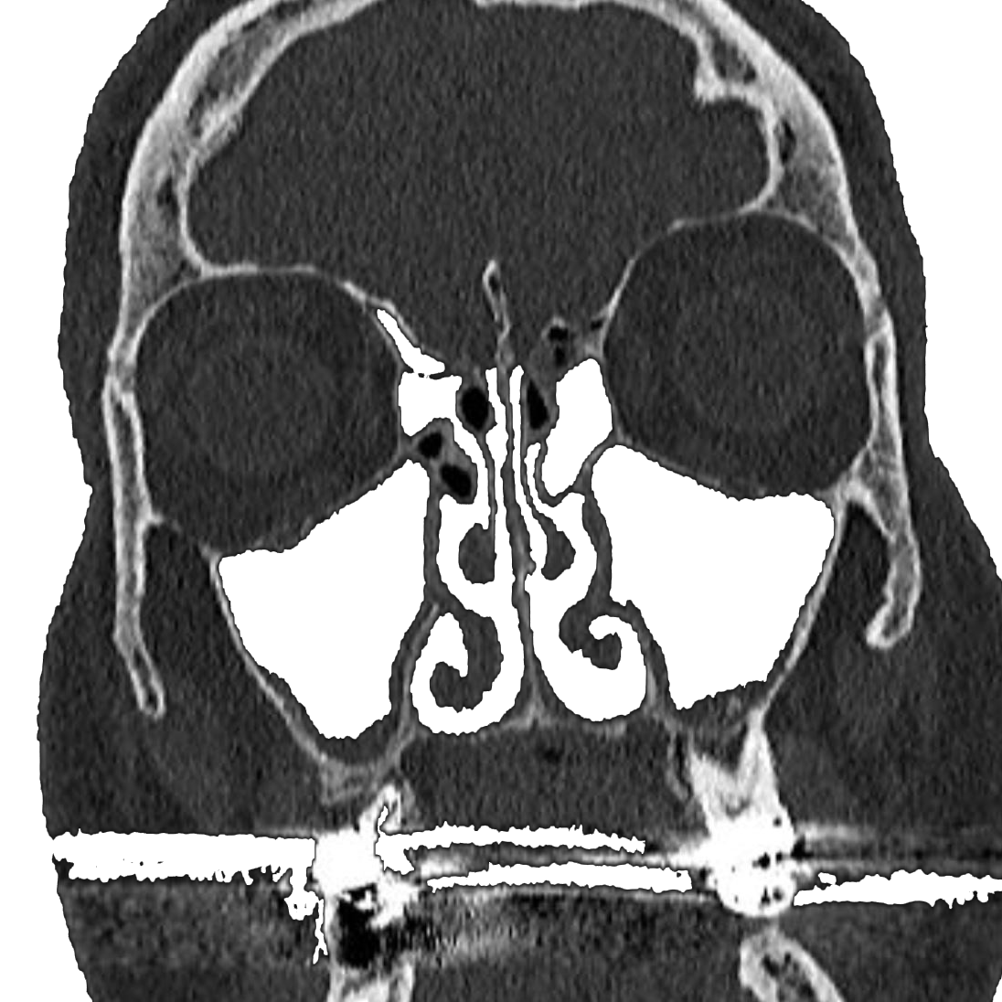 Sinus-Transparent
